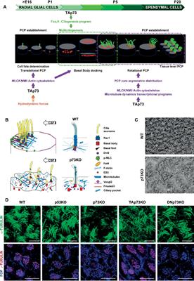 The Trp73 Mutant Mice: A Ciliopathy Model That Uncouples Ciliogenesis From Planar Cell Polarity